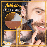 تكبير وملأ فراغات اللحية مع ديرما رولر