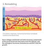 تكبير وملأ فراغات اللحية مع ديرما رولر